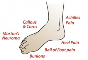 Common Causes of Foot & Ankle Pain PICTURE 1