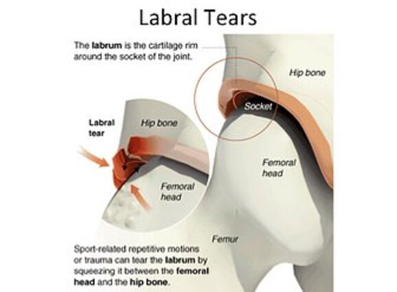  Round Ligament Pain Tear Pad, English/Spanish : Industrial &  Scientific