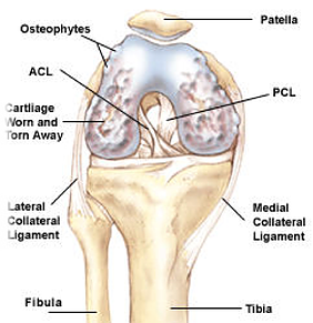 Medial Collateral Ligament Tear - The Surrey Osteopaths